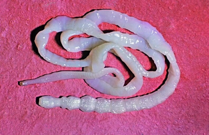 The bovine tapeworm is a common intestinal worm